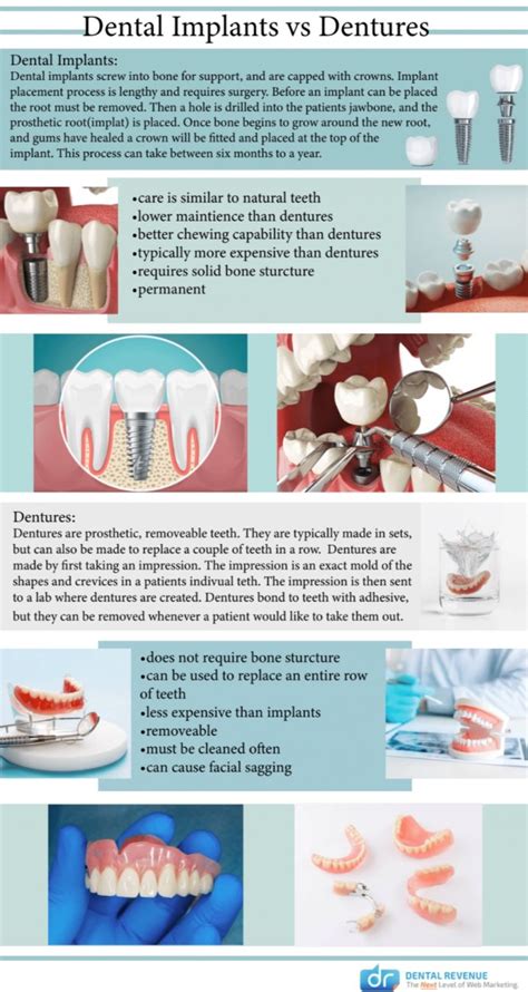 Dental Implants Vs Dentures Cosmetic And Advanced Dentistry