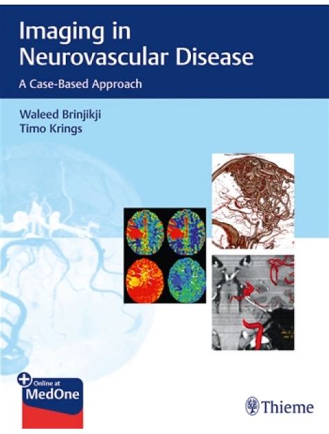 Neurosurgery L Imaging In Neurovascular Disease