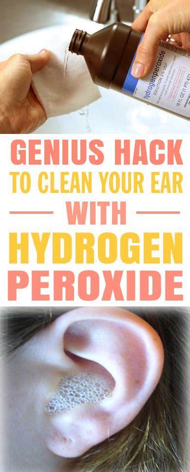 This Is Just The Best Hydrogen Peroxide Hack To Clean My Ear With It