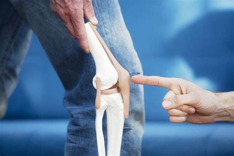 Acute Patellar Kneecap Injuries Overview And More