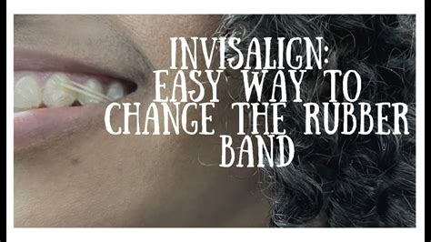 Invisalign Hack How To Easily Hook The Rubber Band Invisalign Youtube