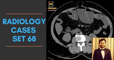 Classic Radiology Cases 4 Spotters Set 68 Radiogyan