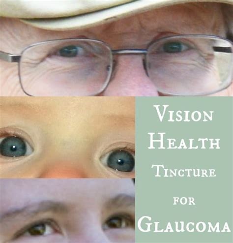 Medical management of glaucoma is an art form. Natural Remedies for glaucoma treatment