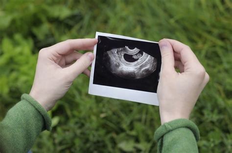 How To Read A Baby Sonogram
