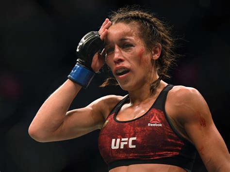 Joanna Jedrzejczyk Shows Off Healing Forehead After Suffering Horror