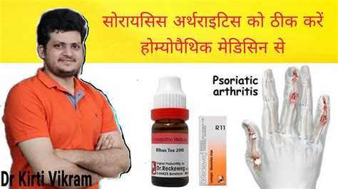 Psoriasis Arthritis Homeopathic Medicine For Psoriasis Arthritis