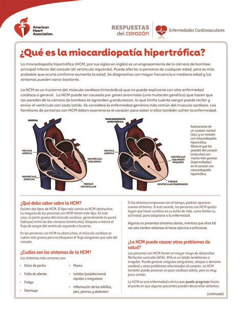Text Qué es la miocardiopatía hipertrófica HealthClips Online