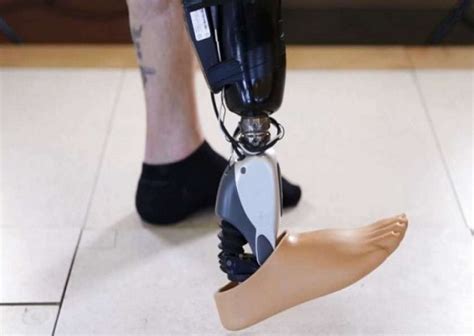Say Hello To Worlds First Mind Controlled Bionic Leg For Am