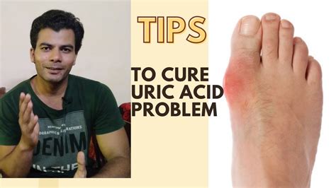 How To Manage High Uric Acid Level Do S And Don Ts Purine Foods यूरिक एसिड कैसे घटायें Youtube