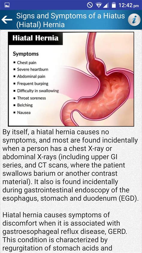 What Not To Eat With A Hiatal Hernia 1 ﻿ As Many As 90 Percent Of