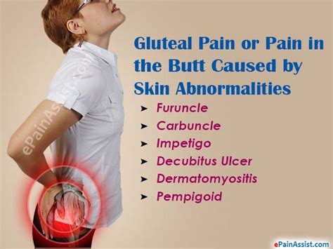 What Can Cause Gluteal Pain Or Pain In The Butt
