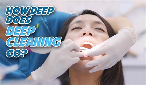 Whats The Difference Between Deep Cleaning And Regular Cleaning At The Dentist Everyday Smiles