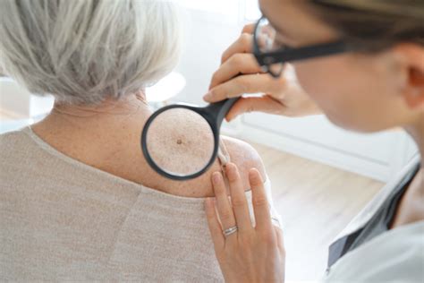 What To Expect From A Yearly Skin Exam Epiphany Dermatology