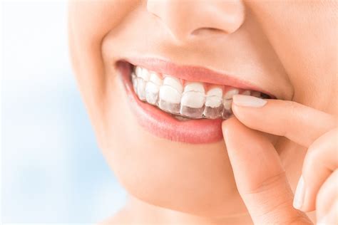 Does Invisalign Hurt — Legacy Orthodontics