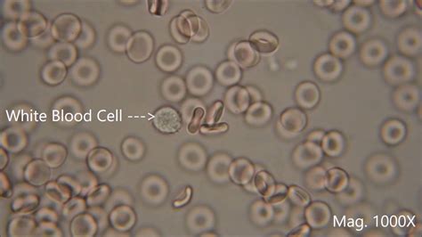 Red Blood Cells Under Microscope Labeled