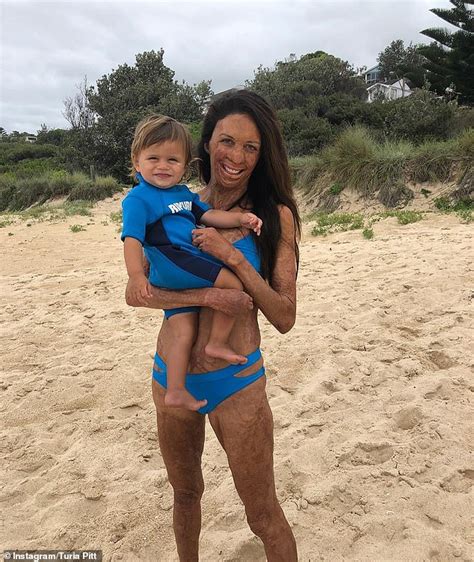 Burns Survivor Turia Pitt Reveals She Has Cut Back On Her Recovery Due