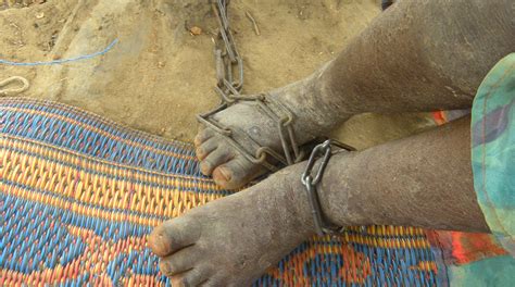 In West Africa Mental Illness Is Treated With Chains And Shackles