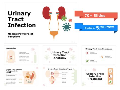 Download Urinary Tract Infections Powerpoint Template Rxslides