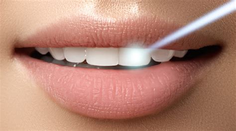 understanding the technical side of laser dentistry wilton smiles