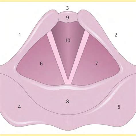 72 Year Old Female Patient With Lingual Goiter And Left Sided Paresis