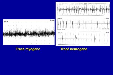 Alamat jne di yogyakarta berikut ini juga telah kami update untuk kantor pusat pengiriman sorogenen no. PPT - Transmission de l'influx nerveux (bases) EMG en réanimation (pathologie neuro-musculaire ...