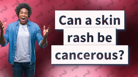 Can A Skin Rash Be Cancerous Youtube