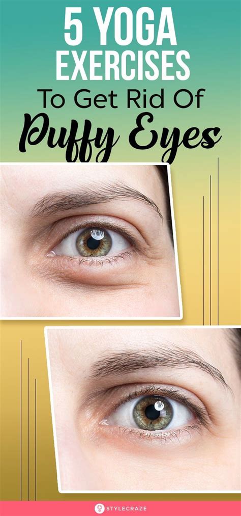 How To Fix Droopy Eyelids 12 Easy Ways Healing Picks