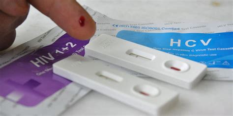Give Hiv Home Test Kits To Men Who Have Sex With Men Say Researchers