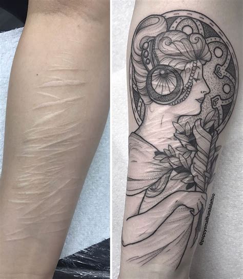 You don't have to cover up your scars with a tattoo, incorporate them into the design. This Woman Wanted Her Tattoo To Cover Up Her Self-Harm ...