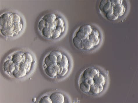 More Ivf Questions How Many Embryos To Transfer The Plusminus Rule