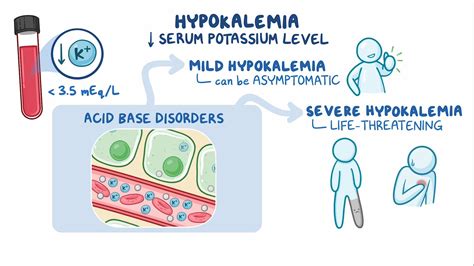 Approach To Hypokalemia Clinical Sciences Osmosis Video Library