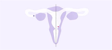 Ovulation And Implantation Signs And Symptoms