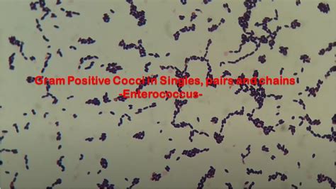 Gram Positive Cocci In Singles Pairs And Chains Of Enterococcus