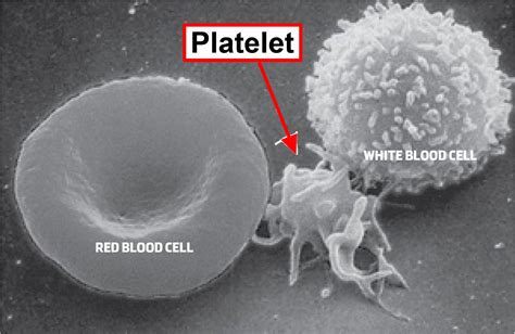 Platelet Count High Low Platelet Count Causes Treatment
