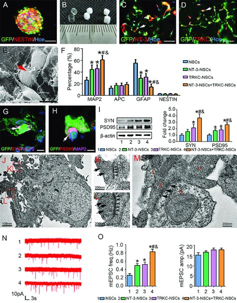 Co Culture Of NT 3 NSCs And TRKC NSCs In 3D GS In Vitro To Establish An