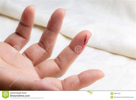 Your blood hurt stock images are ready. Injured finger stock image. Image of hand, bleed, hurt ...