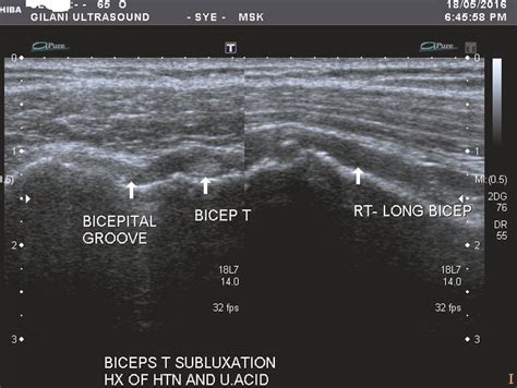 Who Is Interested In Msk Ultrasound Researchgate