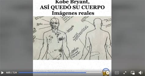 Kobe Bryant S Autopsy Heartbreaking Leaked Images Photos