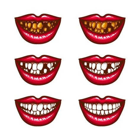 Mouth Missing Teeth Clip Art