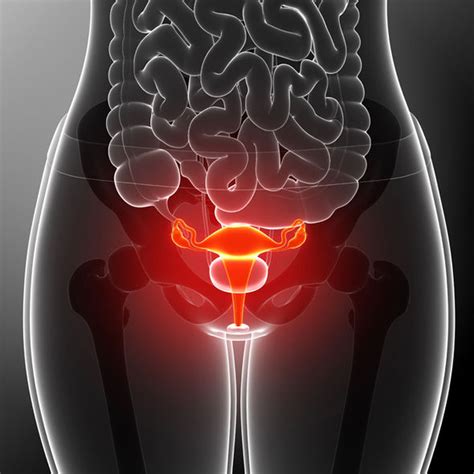 In later stages, symptoms could include: Cervical cancer symptoms - unusual bleeding a sign you ...
