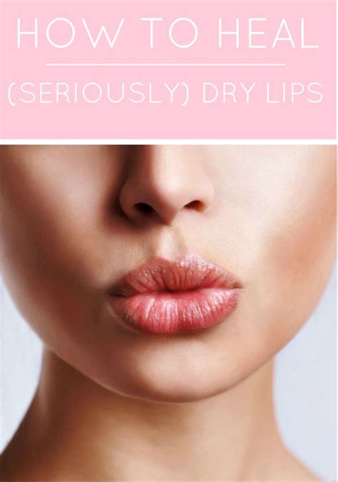 How To Heal Chapped Lips The Dumbbelle Cure For Chapped Lips