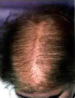 Screening to establish these levels in cases of hair loss and supplementing with them when they are deficient may be beneficial in the treatment of disease. Pin on Maquillaje, vestimenta, belleza, otros
