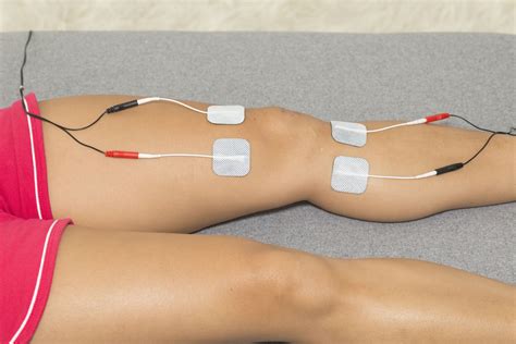 Types Of Electrical Stimulation Used In Pt