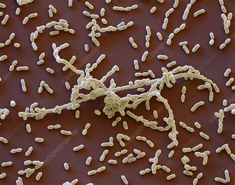 Pasteurella multocida — вид грамотрицательных бактерий из семейства pasteurellaceae. Pasteurella bacteria, SEM - Stock Image - C002/5848 ...