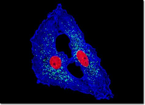 Molecular Expressions Microscopy Primer Specialized Microscopy