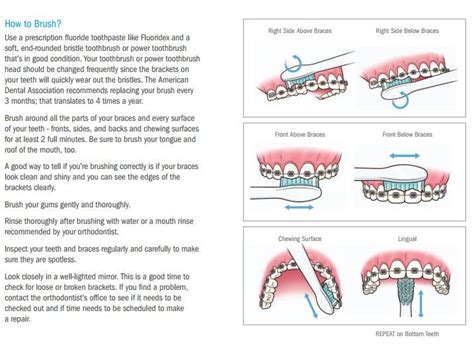 Brushing your teeth with braces is pretty straightforward, but it does take a couple of extra steps. How to brush while in braces. www.beorthodontics.com # ...
