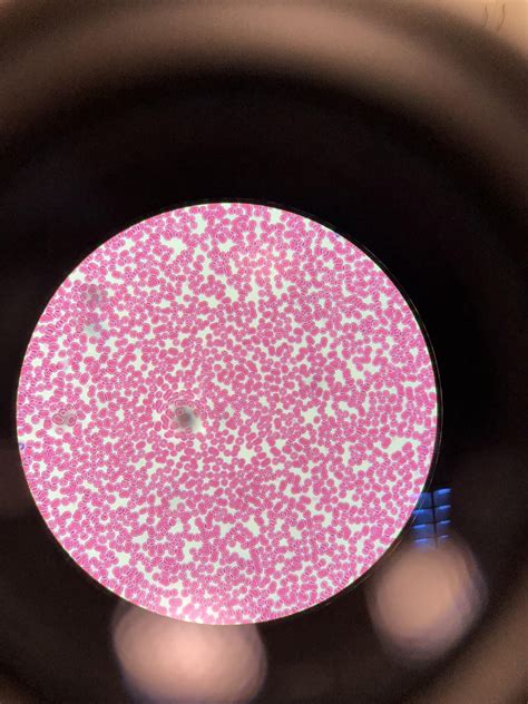 Red And A Few White Blood Cells As Seen Through An Electron My Xxx