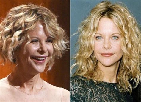 Meg Ryan Plastic Surgery Ryan Destroyed Her Face With Botox And