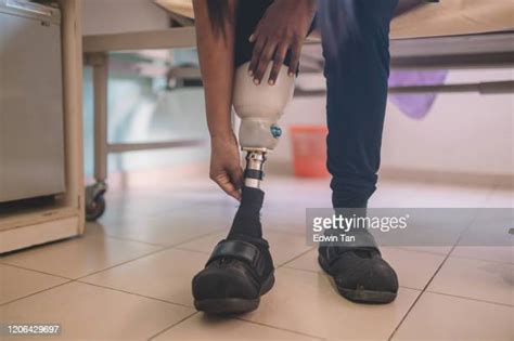 Prosthetic Leg Hospital Photos And Premium High Res Pictures Getty Images