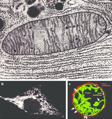 Mitochondria Electron Micrograph Labelled
